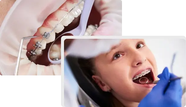 Ortodonta aparat na zęby białystok